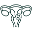 Cáncer de cuello uterino
