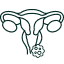 Cáncer de vagina2