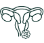 Cáncer de vagina